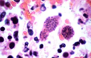 Toxoplasma, Schizophrenia, and Cats: Their Connection with You ow.ly/AC2H306Nz9J