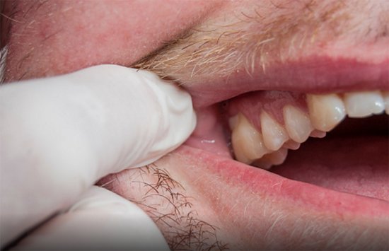 KitchenerGroup's tweet image. Gum disease affects the tissue of the gums and also the underlying jawbone. Learn about types of gum disease: goo.gl/LiNzNj