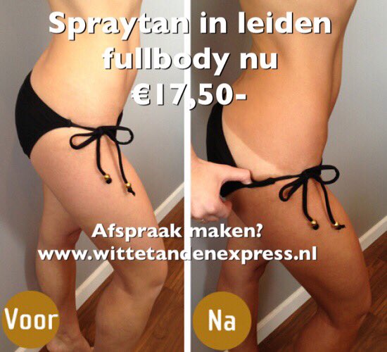 Mooie bruine vakantie kleur? wittetandenexpress.nl