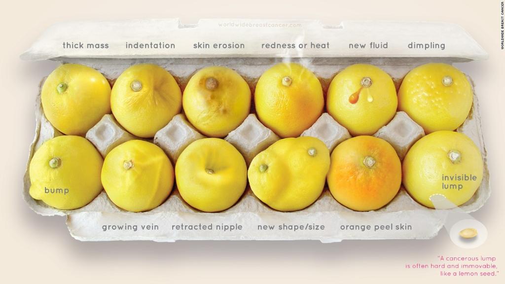CNN's tweet photo. This carton of lemons offers simple lessons about breast cancer https://t.co/Rv7fY2wsq5 https://t.co/NxRivFQMxj