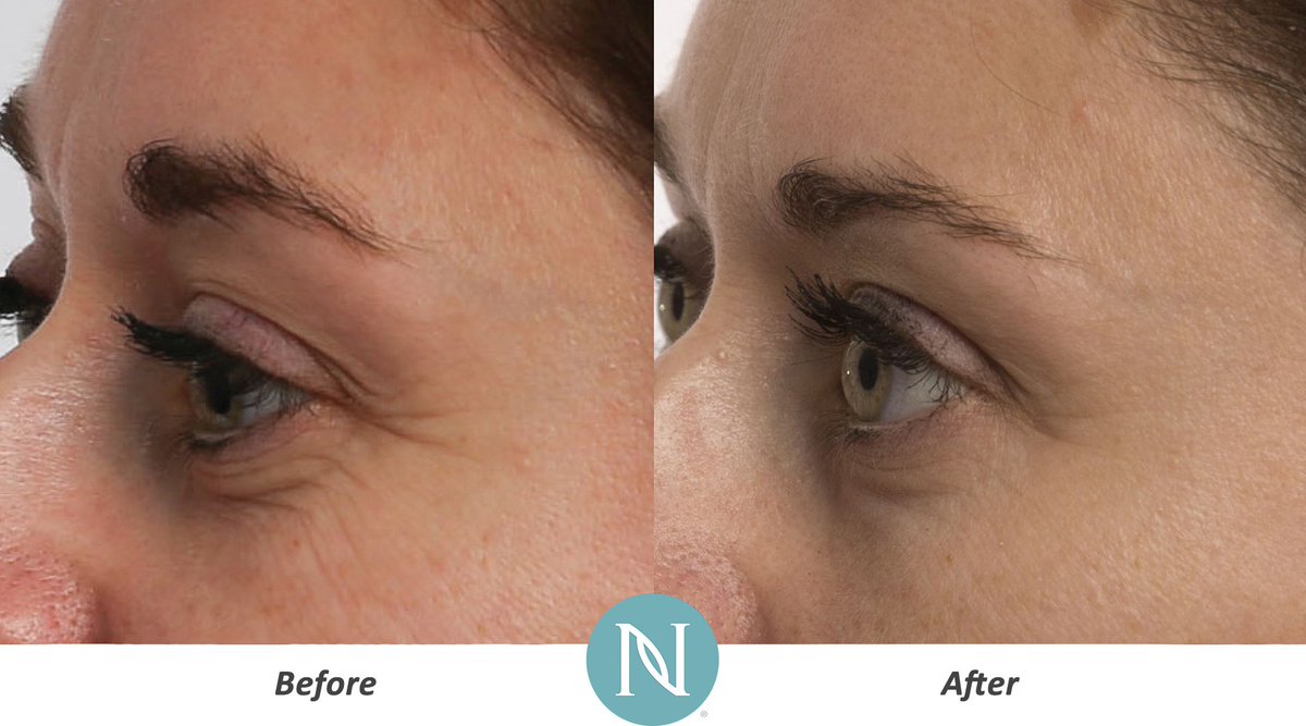 binsummy's tweet photo. Shed years off of your appearance with Nerium Age-Defying Cream, Optimera Formula! Regain your youth now:  https://t.co/P4mjOCkfW8 https://t.co/D4ztMLXH9Z