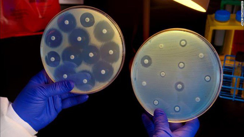 CNN's tweet photo. A drug-resistant superbug called CRE may be more widespread than previously known https://t.co/eUqp2SUzD9 https://t.co/rRKeen2ebQ