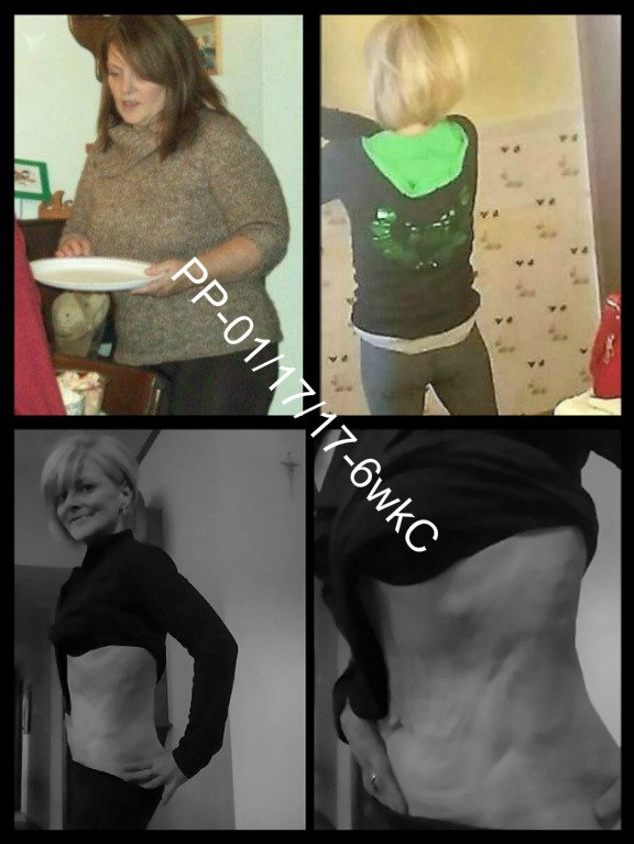 macro_me's tweet image. Happy #transformationtuesday! 
Loss:133# loss.
Gains: Life &amp;lt;3
When you think you can&apos;t, know you can!
#lowcarb #keto #paleo #fit #healthy