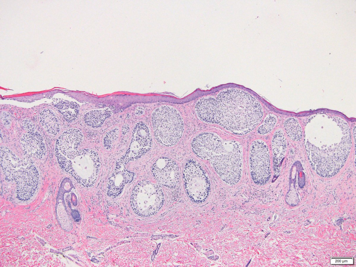 Dermpathl tweet picture