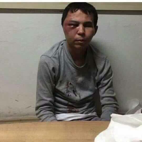 Ankara Trafik Radar on Twitter "reina saldırgani kansız itin son hali