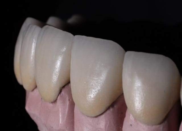 Pregunta por nuestros tratamientos y los descuentoa que tenemos en Dental Esthetic Center