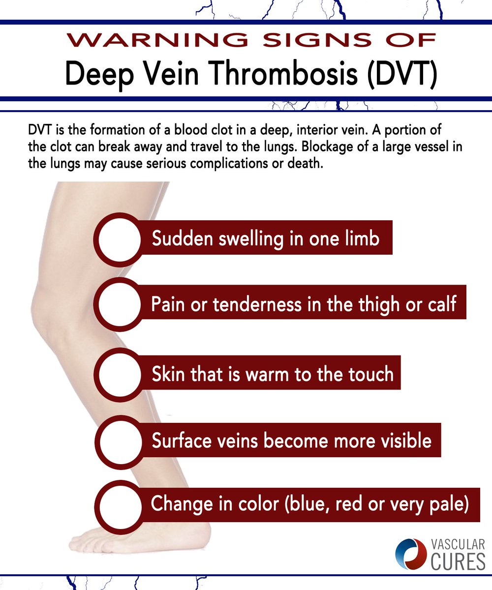 Dvt Warning Signs