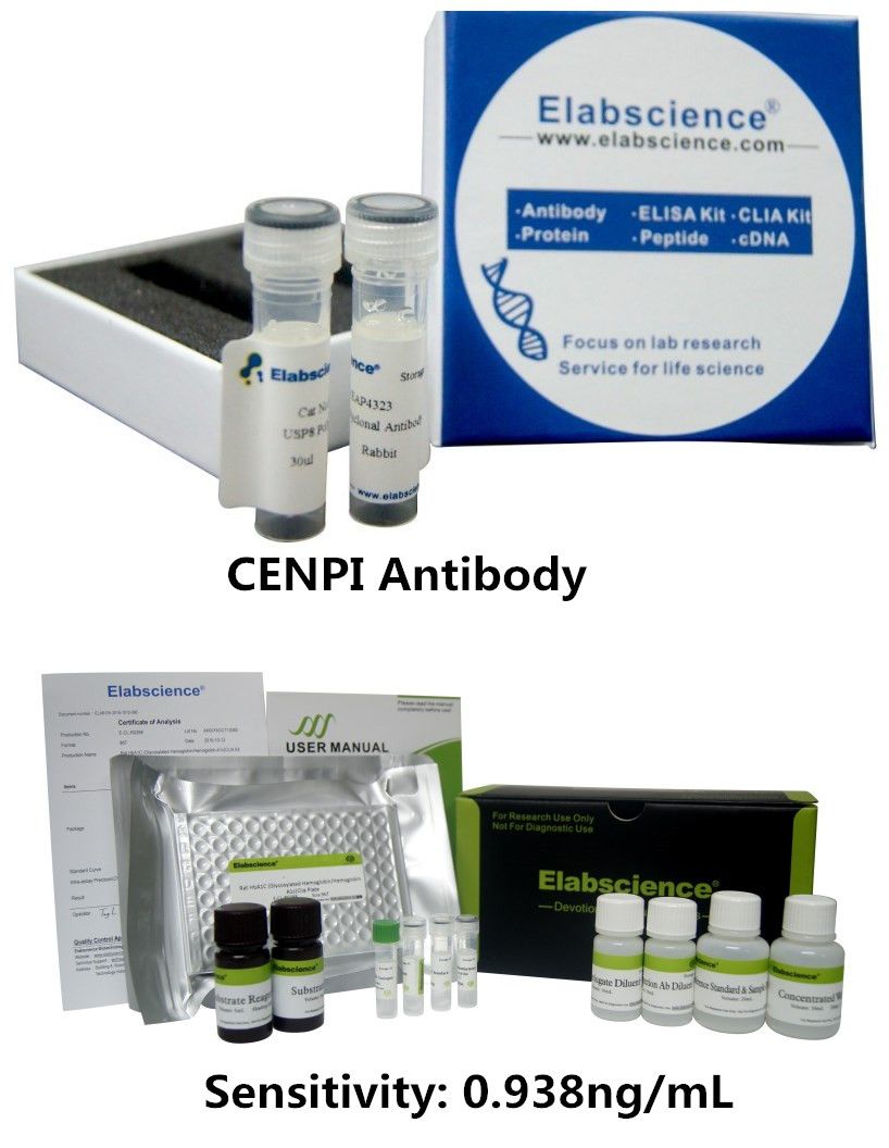 Elabscience_bio's tweet photo. Elabscience Presents #Antibodies and #CLIAKits for research.
#CENPI #Antibody, Mouse FSH #CLIAKit https://t.co/Jpl3Rmnq17 https://t.co/cuw7Ix5V9s