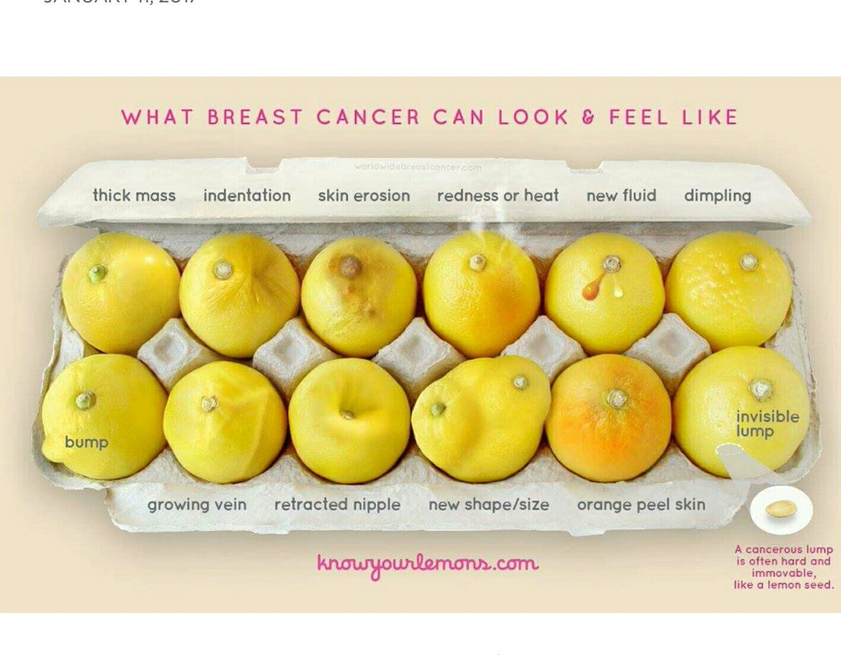wearsacapeling's tweet photo. Where my girls at? @knowyourlemons  @AmericanCancer   💟🍋🍋 #TuesdayMotivation #Awareness #breastcancer #breasthealth #breastcancerawareness https://t.co/C747z2cLqI