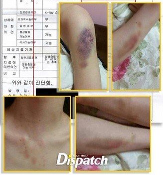 offensivekpop's tweet photo. fotos: https://t.co/oIlMWDy7WN