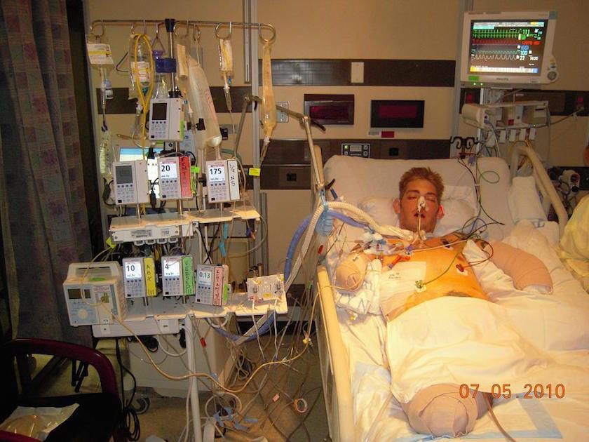 wwp's tweet photo. Motivating. "A Story Of Survival: How I Came Back From Losing All 4 Limbs" Via: @TaskandPurpose https://t.co/eu7tCZWKN2 https://t.co/LKzqzS8IFn