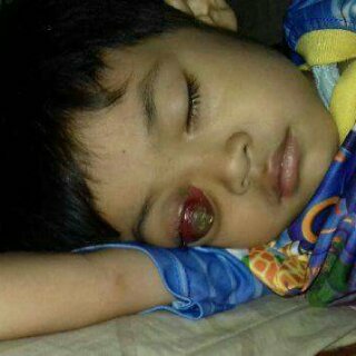 Soumeth_travis's tweet photo. Kasian anak ini ya alloh, tolong angkat penyakitnya🙏
Ini masih org jawa barat.
@DediMulyadi71 
@XTC__Indonesia 

Sampai menetes air mata ini https://t.co/WAVQD0nr7v