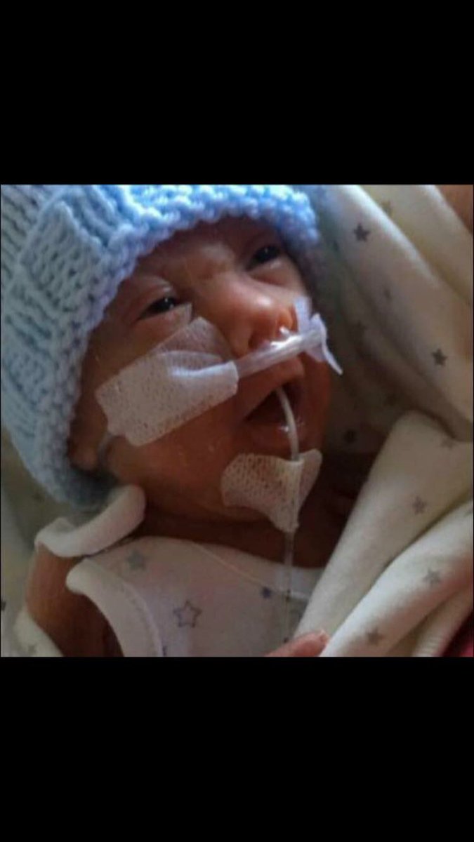Drea_Dollx's tweet photo. You can follow Juniors amazing Journey here and see what a special boy he was👼🏼💙 https://t.co/nYwPUfNBUE https://t.co/nOv1LtG1tO