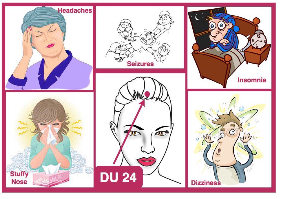 AcuProAcademy tweet picture