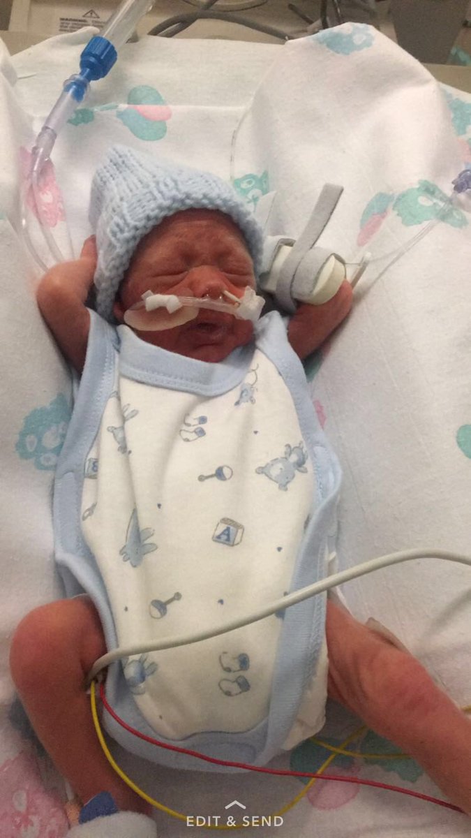 Drea_Dollx's tweet photo. https://t.co/M6wAfixUFq ... Please help us make Juniors last journey the best wee can , please share our go fund me page 💙 RIP angel 👼🏼💙 https://t.co/UV3jR2NJ1u