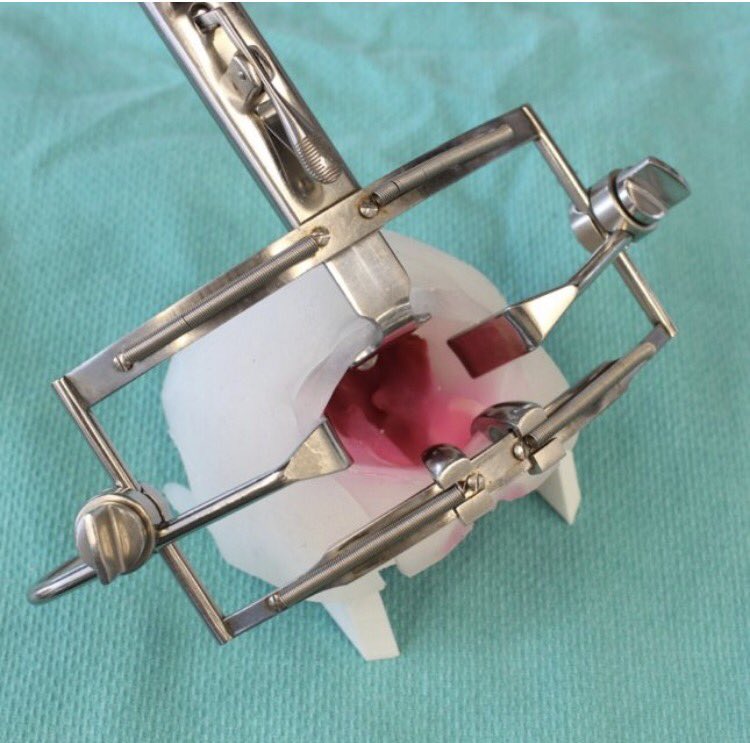 #3dprinting helps train  #plasticsurgeons to fix  #cleft palates statnews.com/2017/01/09/cle… #plasticsurgery