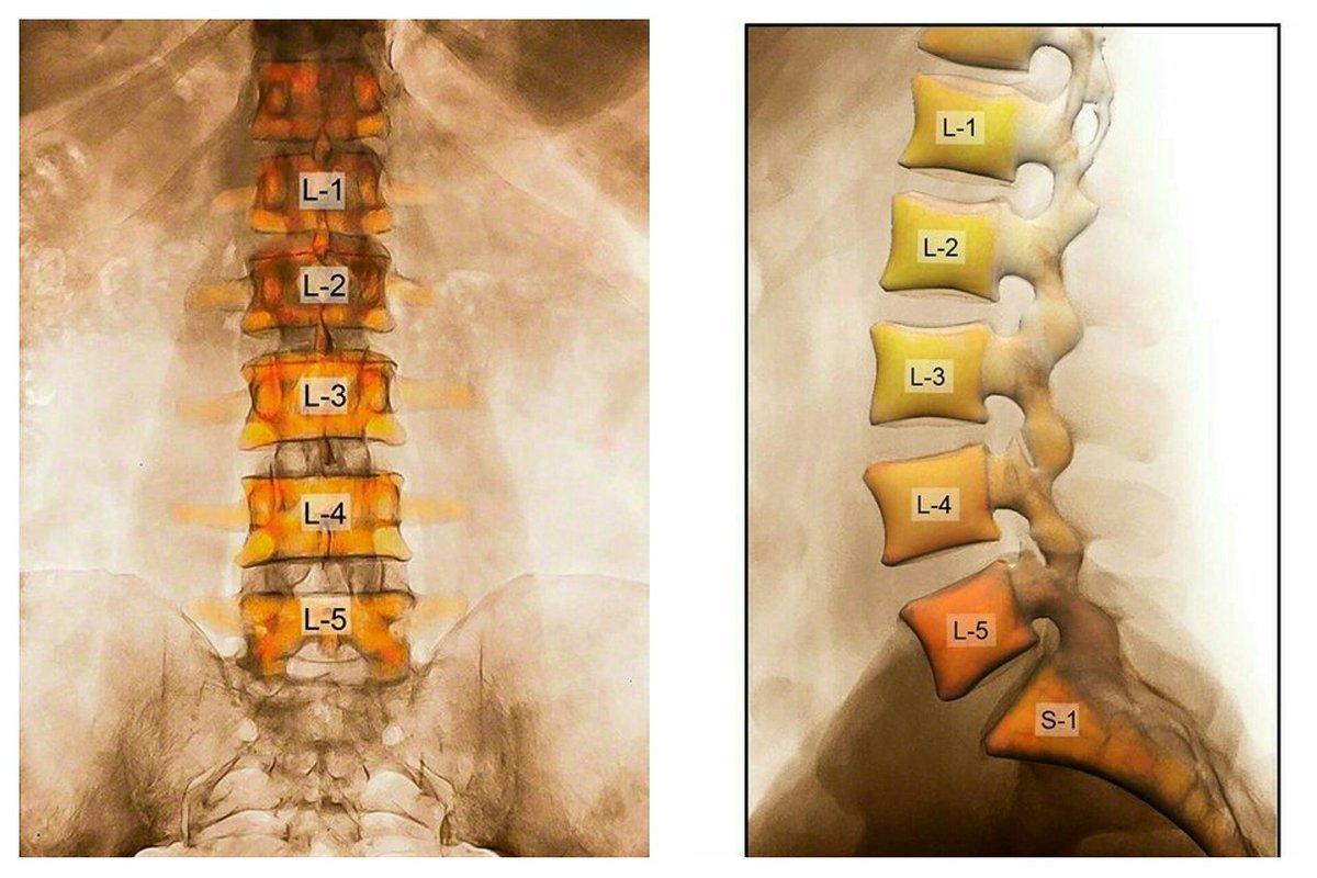 MiguelDlaCamara's tweet photo. Utilidades en #Radiología del realce con color para la imagen radiológica
Artículo en https://t.co/3mwilzQAqO
#xray #radiology #techrad https://t.co/n99q1JUESd