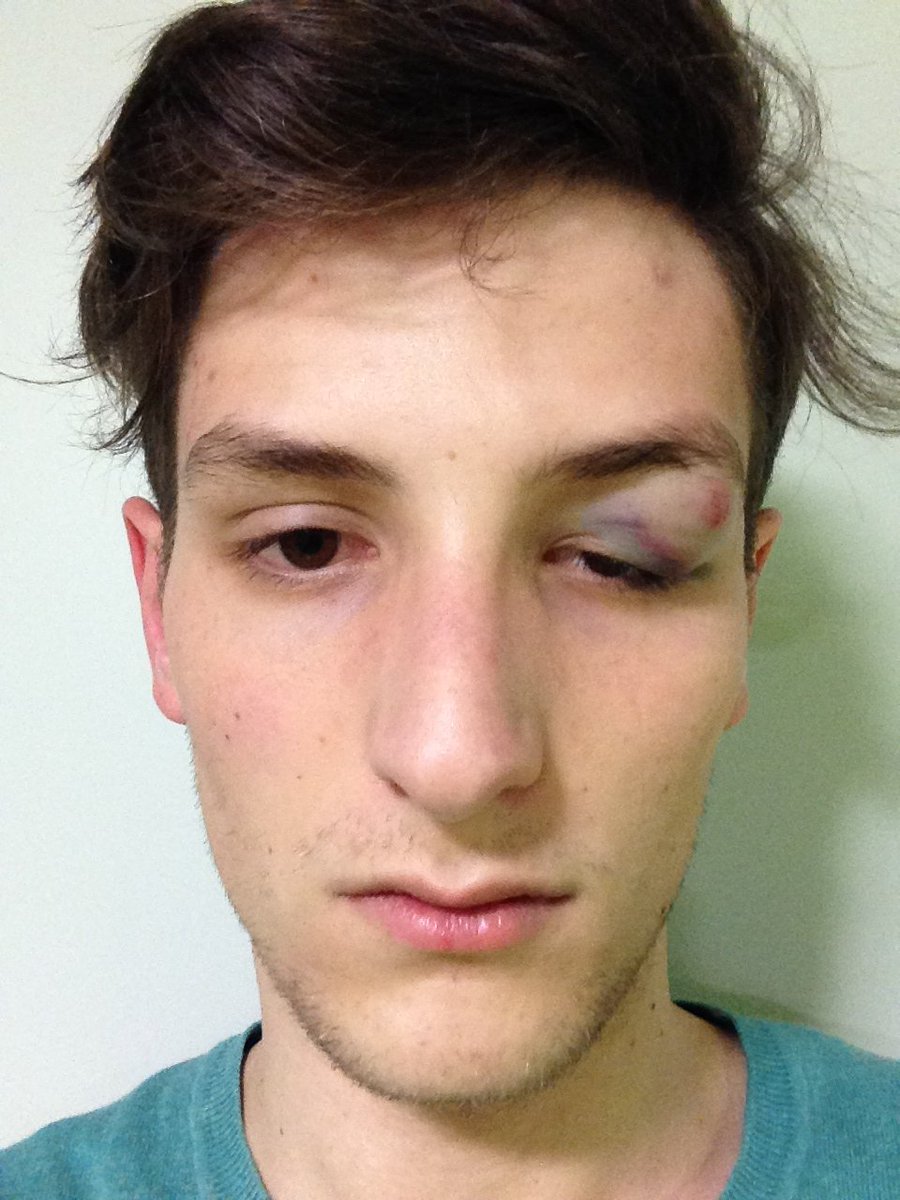 cedpra's tweet image. La justice française 3 ans après mon agression n'a toujours pas jugé l'affaire.
Pour #ManuelValls elle n'a pris que 24h. #gifle #GifleValls