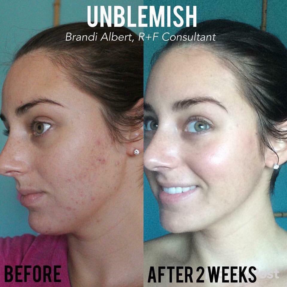 terrid614's tweet photo. Are you in the #Cleveland area abd looking for a very part time opportunity to bring you residual income, great skin and new friendships?! https://t.co/OwekDybZYx