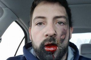 dec3pub's tweet image. Explosão de cigarro eletrônico causa queimadura de 2º grau.
Confira: goo.gl/hz0a97