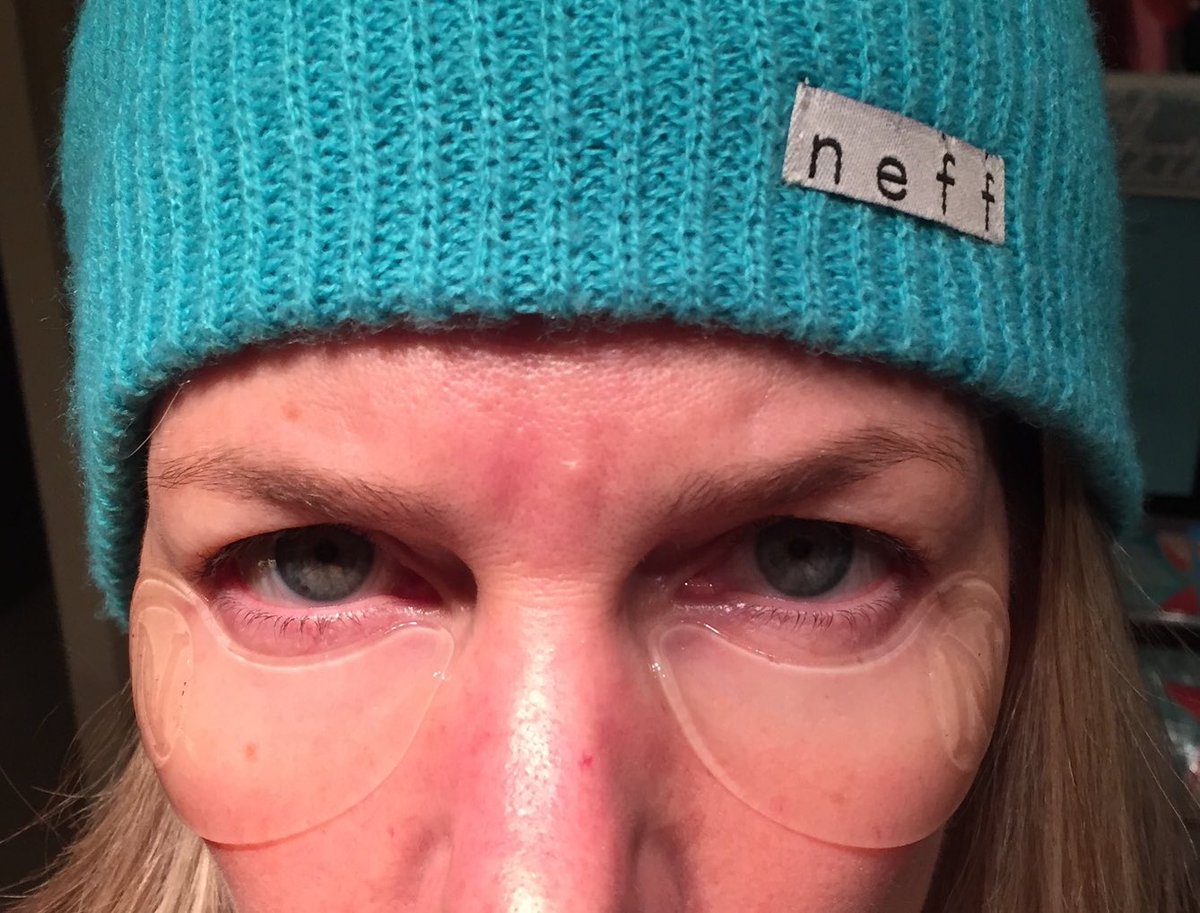 shearjoychelan's tweet photo. These #new #EyeV hydrogel patches are so cool! Check out my 20 min #results &amp; video https://t.co/EE6puBsoTn In-home #spa #eyelift #beauty https://t.co/fp4wDVZHed