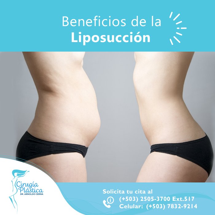 drarnoldocerna's tweet photo. Beneficios de la #Liposucción resultados inmediatos. En pocos minutos la grasa indeseada se extrae del cuerpo. #Cirugíaplástica https://t.co/LzV4ePHjsj
