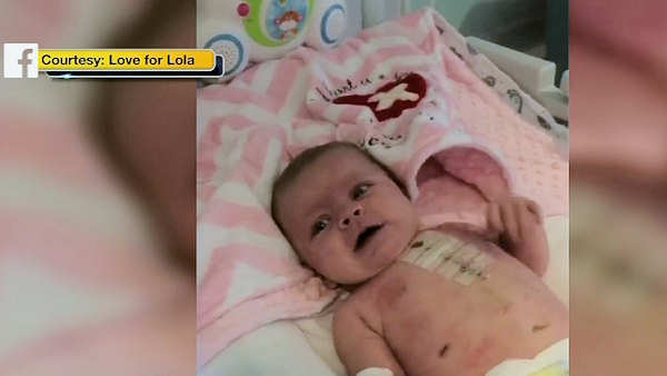 ABC7NY's tweet photo. Baby with heart defect stops crying when watching Dallas Cowboys: https://t.co/ZqVbxiGU2N https://t.co/DOJowJ9aI4