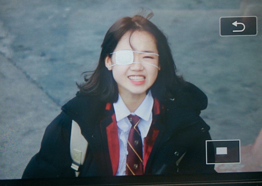 IOIOffical's tweet image. 170119
I think Yoojung hurt her eyes?! 😭 (pic Cr. EverydayYJ)