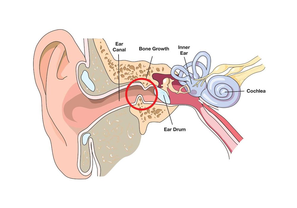 LabelparkFR's tweet image. L'hiver est là, protégez vos esgourdes ! 👂💦🏄
@Surfersvillage Article: bit.ly/2k3TsPj
