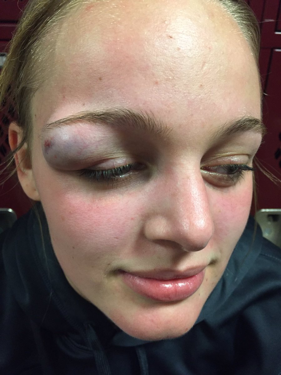 LexiBoven's tweet photo. When your ego is too big for your head🤕 https://t.co/oG2AzQvjXM