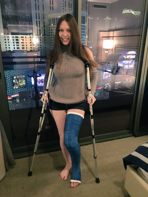 I broke my leg, I got the cast on today. https://t.co/mIEpvvieYF<a href="/tag/model"class="tags"><span>#model</span></a><a href="/tag/sexysunday"class="tags"><span>#sexysunday</span></a>