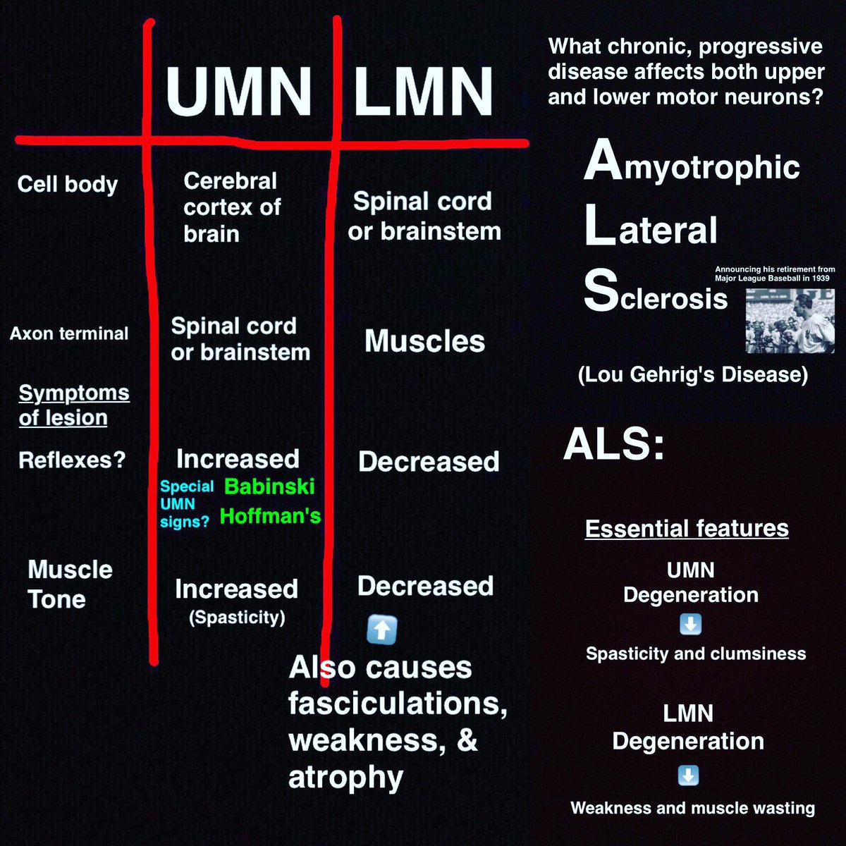 Upper And Lower Motor Neuron Lesions Mnemonic Series 5 Motor Neuron