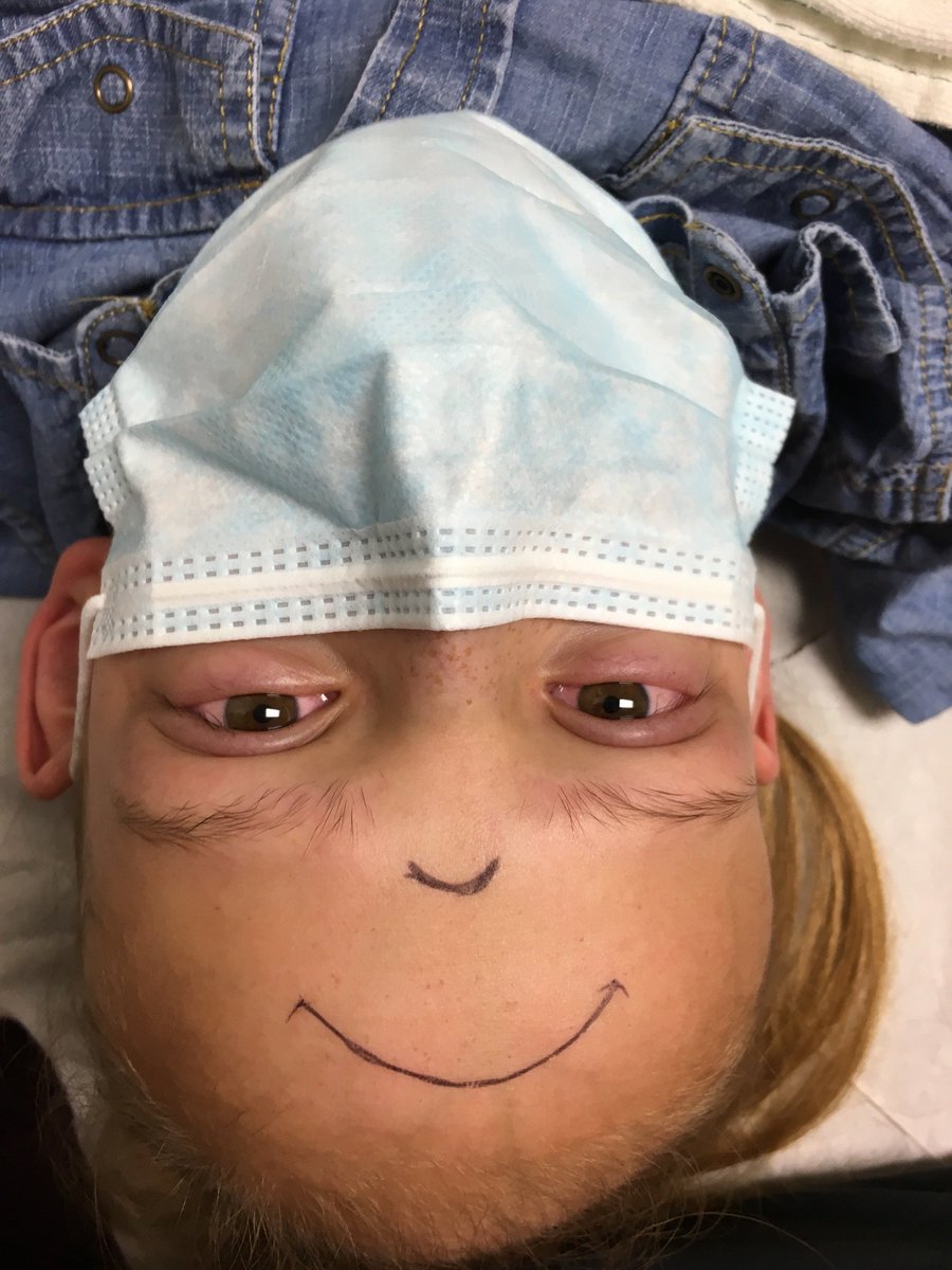 shayleebriones's tweet photo. my cute baby sister who finished chemo AND got her picc line out AND is a happy monkey even though she has (cute) teary red eyes :') https://t.co/kJhr6xdfsr