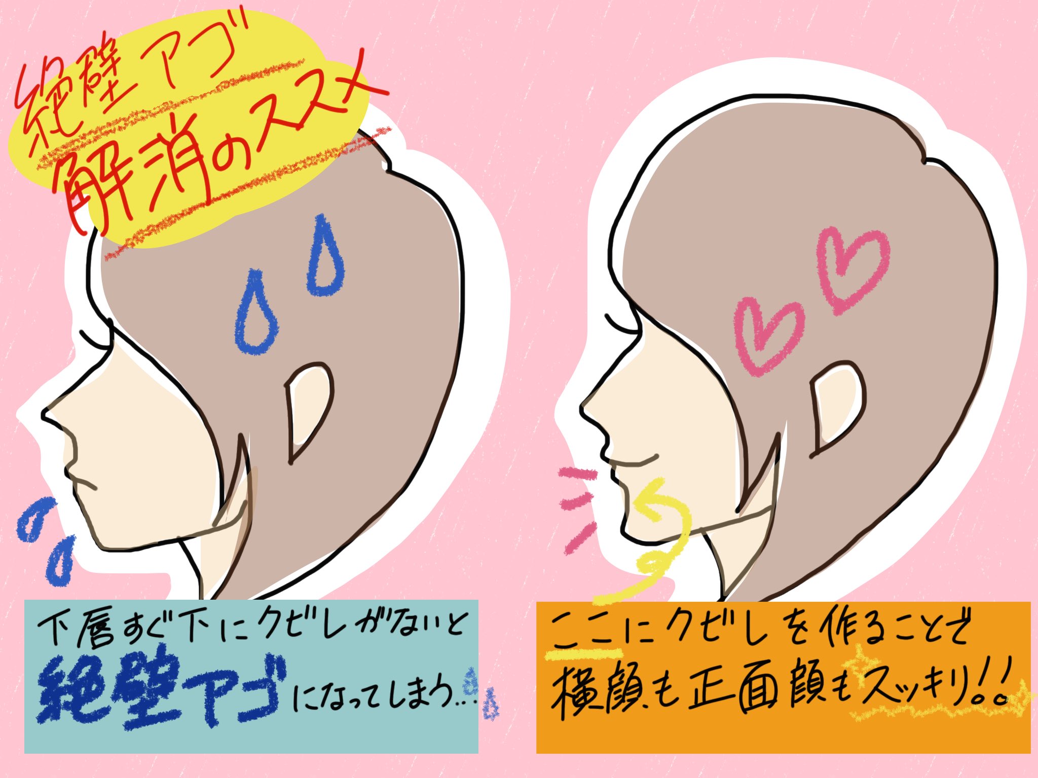 白鳥 紘子 Hiroko Shiratori アゴの梅干し部分に出来るコリをほぐすと 下唇のすぐ下あたりにクビレが出来ます このクビレを作ると横顔ラインにメリハリが出来 正面から見た際には小顔に見えます クビレ部分を押すと歯茎に圧がかかって痛いので 必ず