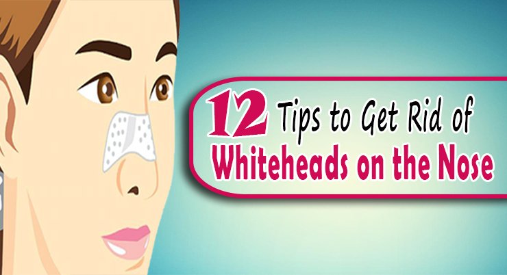 nobodyproblems's tweet photo. 12 Tips to Get Rid of Whiteheads on Nose
https://t.co/NGbGskoapu
#Whiteheads #Rid_of_Whiteheads #removeWhiteheads #skincare #NoseArt https://t.co/T7qhB7xhOn