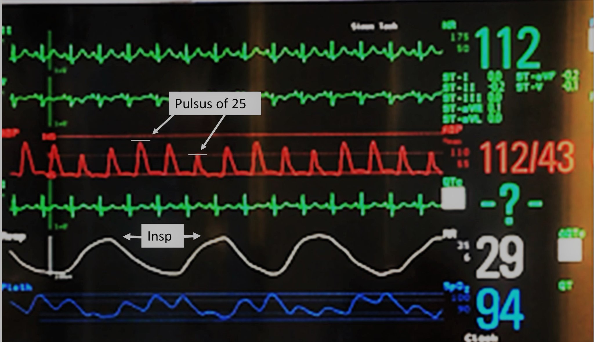 POURING ART タイトル \" the Pulsation \"（脈動 ）\" POURING ART タイトル the Pulsation （脈動 ）