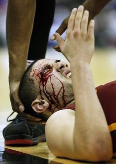 EvilKorey's tweet photo. Leaked pics of Juan last night. Expect his fans to wear a bandaid to the next game to show support. @jdelagarza10 @Mvaostudsec https://t.co/7EJlfB5m5Q