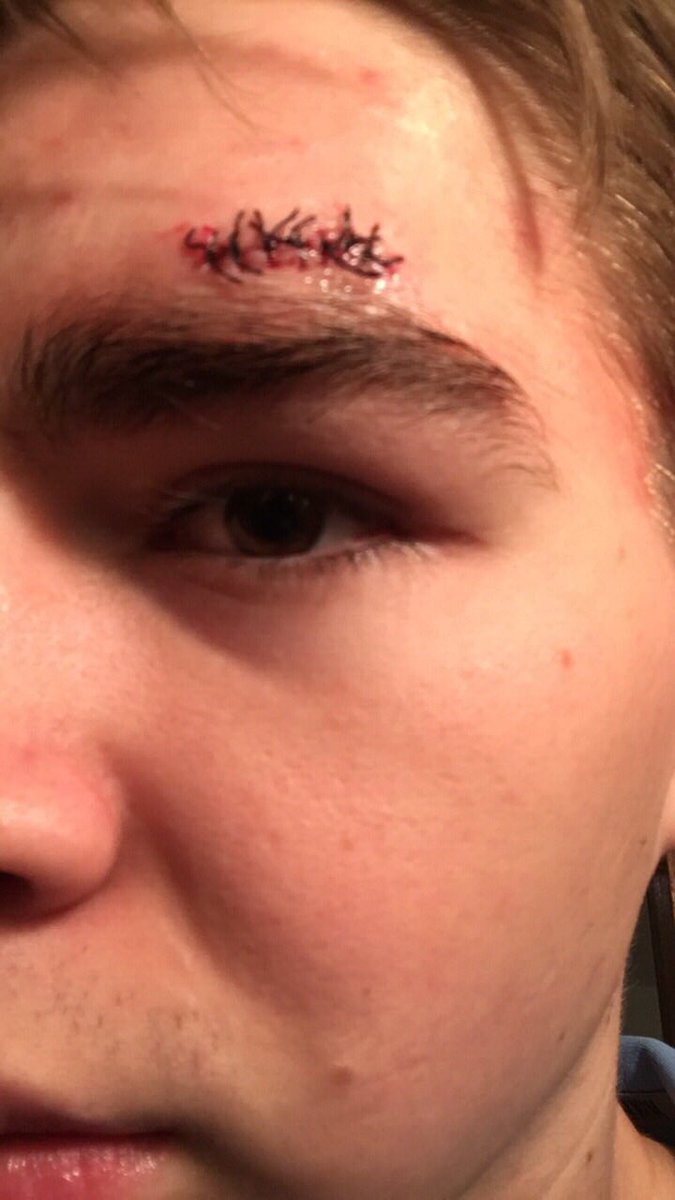 EvilKorey's tweet photo. Leaked pics of Juan last night. Expect his fans to wear a bandaid to the next game to show support. @jdelagarza10 @Mvaostudsec https://t.co/7EJlfB5m5Q
