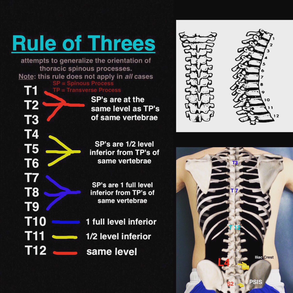 Lumbar Vertebrae Landmarks