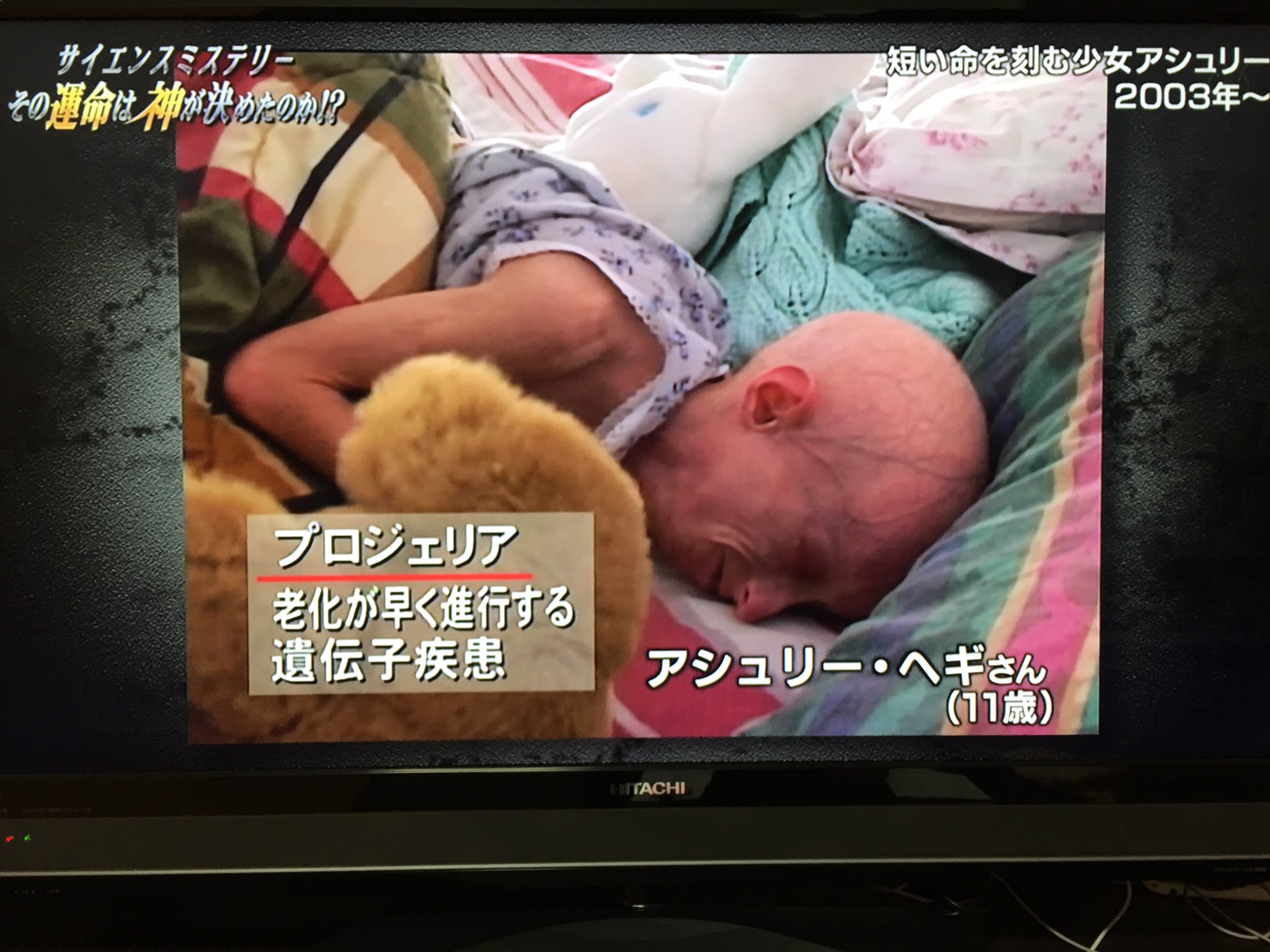 Twitter पर しかちゃんちのさっちゃん プロジェリアのアシュリーちゃんの頃から観てるサイエンスミステリー 胸が苦しめられる時もあるけど みんな強く生きてるんだなってすごく関心 感動する たくさんの個性があることをもっと知りたい