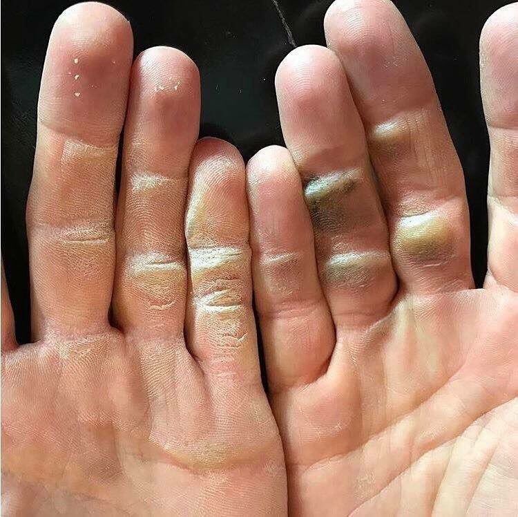 AndrewRiceGolf's tweet photo. Coaches - If you teach junior golfers take a photo of their hands and then compare it to this one. Discuss the comparison. #alexnoren https://t.co/Et5zEXLbOu