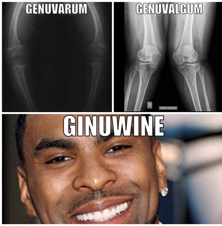 PTLifeProbs's tweet image. THIS STILL GETS ME EVERYTIME 😂😂😂 #ptlifeproblems #ptlifeprobs #ptschoolprobs #ptschookproblems @PTSchoolProbs