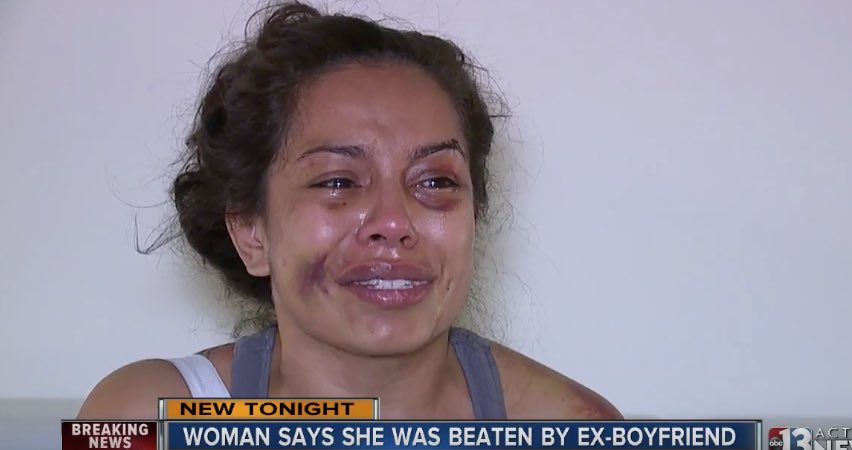 pettyblackgirI's tweet photo. TW:// domestic violence, abuse, bruises 

Angela was beat by an ex boyfriend for trying to leave the relationship &amp; left for dead. https://t.co/SsiFg8rn3Q