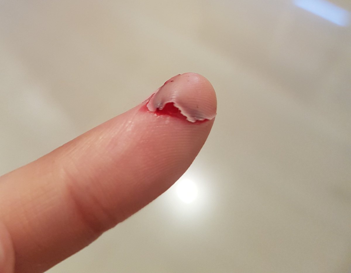 o lado obscuro de cozinhar e que ninguém conta