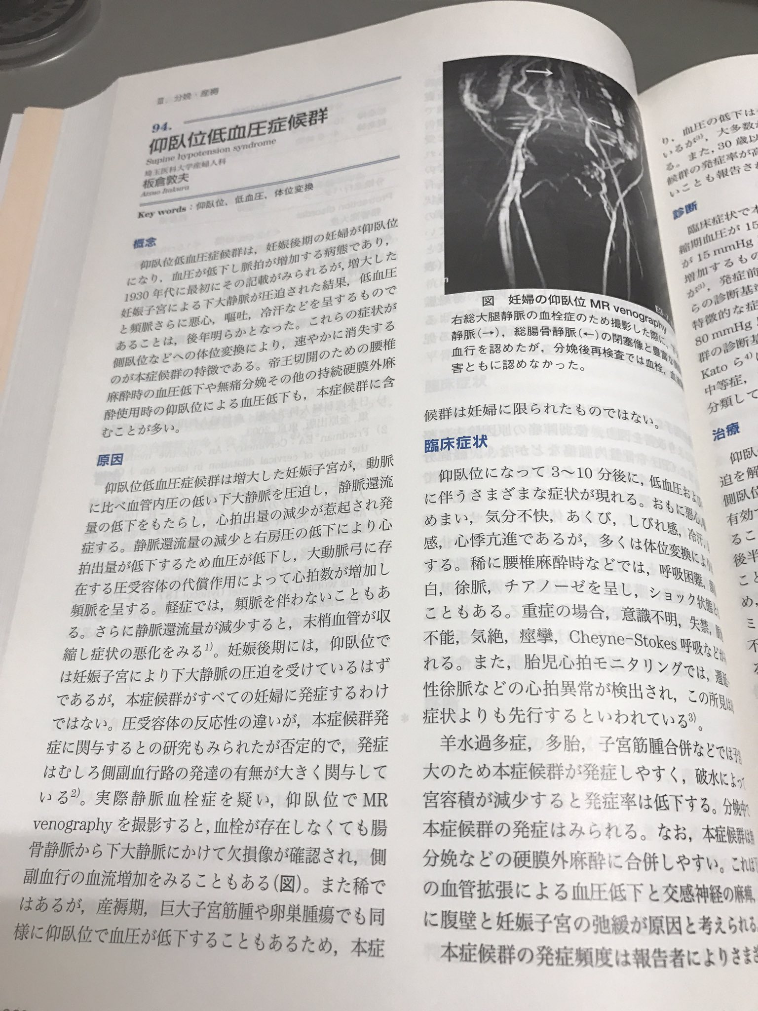 仰臥位低血圧症候群 なりやすい人