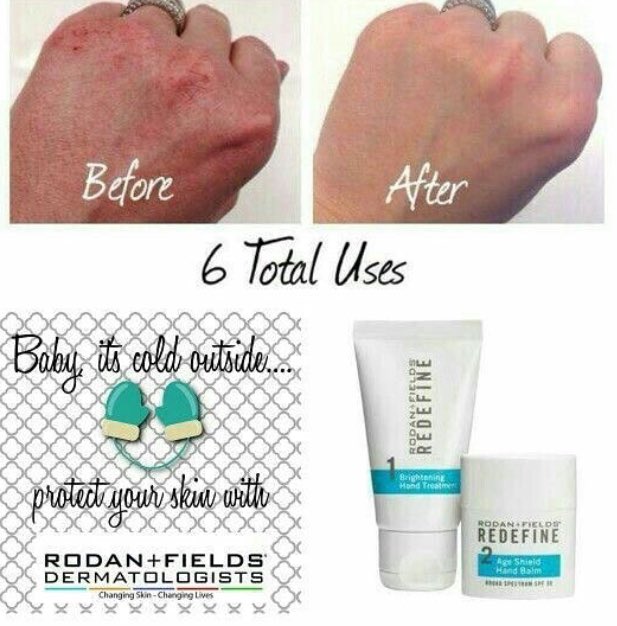 Get your hands winter weather ready with Rodan + Fields hand regimen! Moisturized, soft and younger looking!