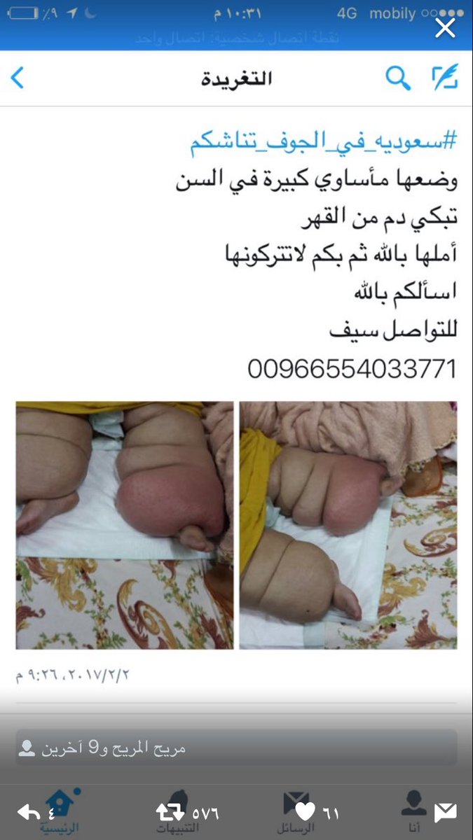 #سعوديه_في_الجوف_تناشدكم