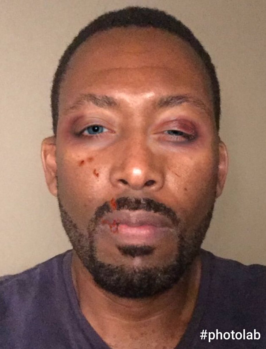 Deej_ProjctUnda's tweet photo. Got ma ass whooped last night https://t.co/LhSzGMraaz