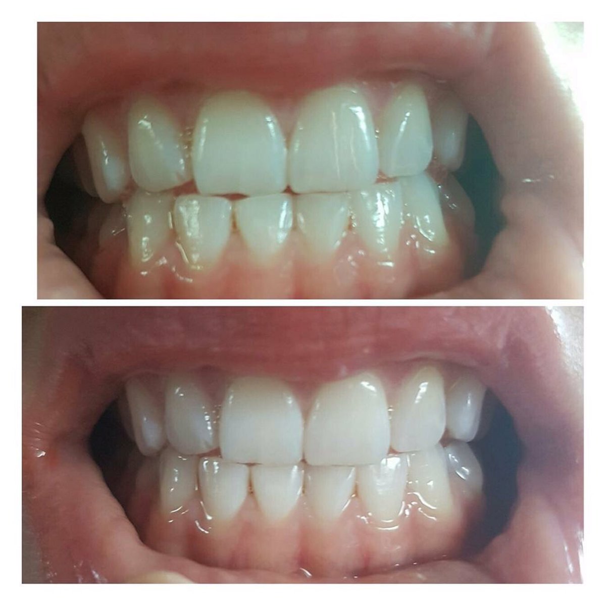LuloBeauty's tweet photo. Perfect smiles all round with our patented whitening toothpaste. No harsh chemicals or peroxide! #whiteteeth #toothpaste #smile #noperoxide https://t.co/3cGh8TRp7C
