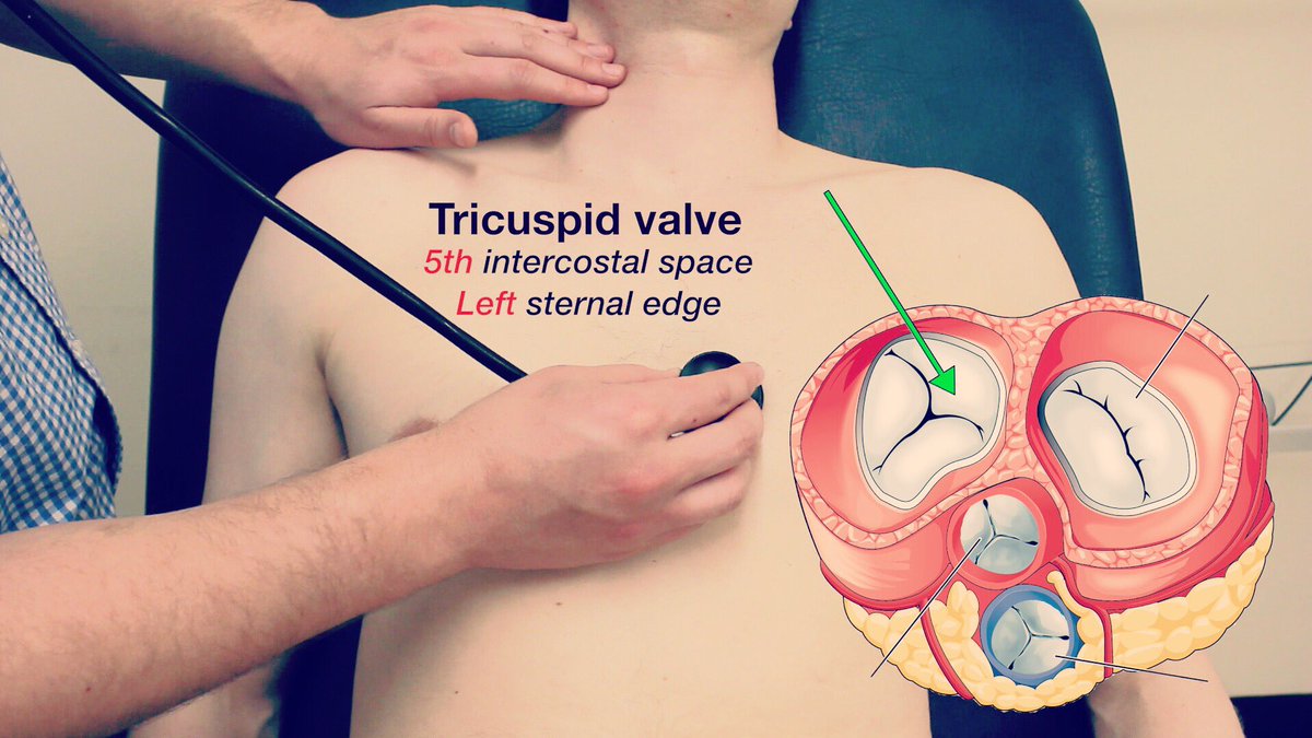 Auscultate the tricuspid valve at the 5th intercostal space, left sternal  edge. ❤❤❤ #meded #cardiology #FOAMed https://t.co/WN4SVDsLbe, image size:1200x675
